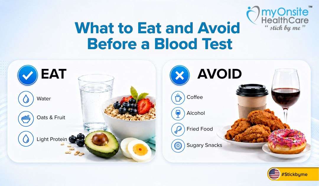 What to Eat and Avoid Before a Blood Test